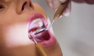 Badanie jamy ustnej. Dentysta używa narzędzi do inspekcji błony śluzowej.