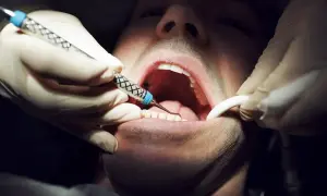 Co oznacza sen o dentyście? Odkryj ukryte lęki i emocje