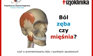 Anatomia czaszki z zaznaczonym mięśniem skroniowym. Jak sprawdzić który ząb boli, czy to ból zęba czy mięśnia? #fizjoterapiastomatologiczna