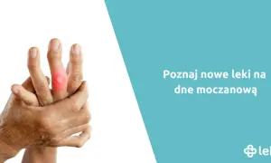Jakie leki przeciwbólowe na dne moczanową mogą przynieść ulgę?