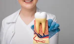 Jak usunąć korzeń zęba bez bólu - krok po kroku do zdrowego uśmiechu