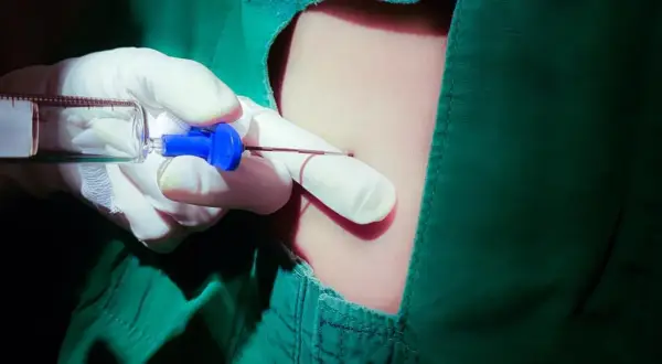 Precyzyjne znieczulenie przewodowe wewnątrzustne. Ręka w rękawiczce trzyma strzykawkę z igłą, gotową do podania środka znieczulającego.