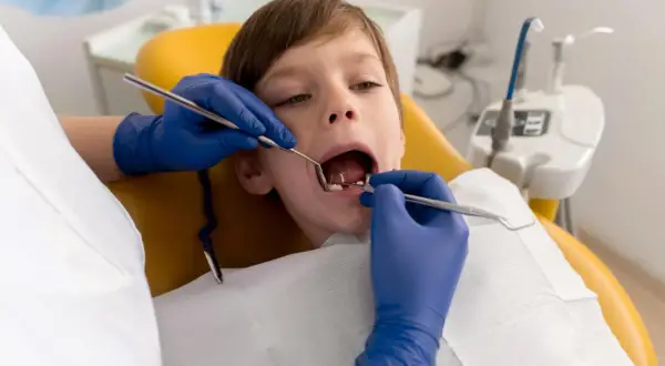 Chłopiec przechodzi leczenie amputacyjne zębów mlecznych. Dentysta w niebieskich rękawiczkach bada jego ząbki.