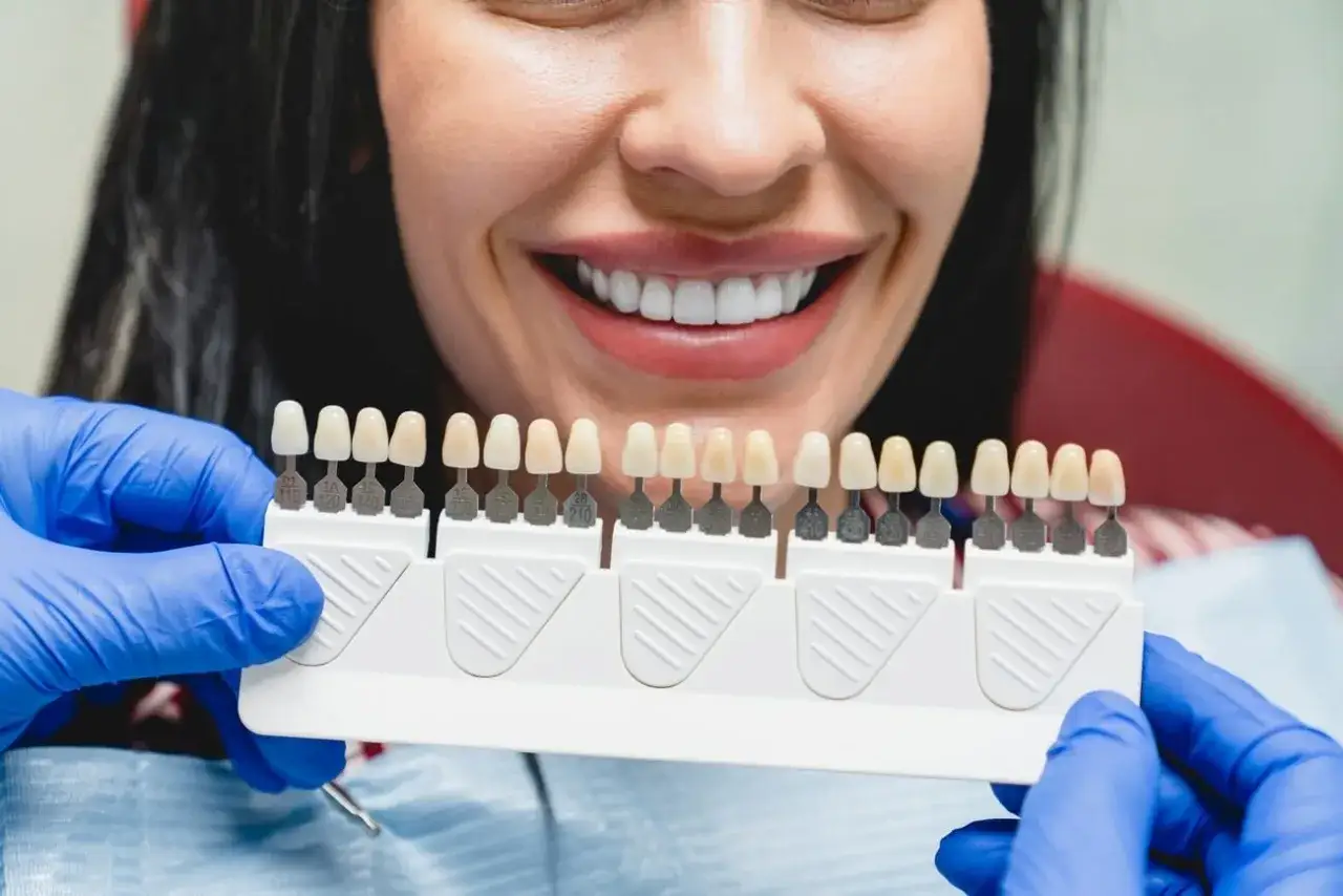 Uśmiechnięta kobieta z białymi zębami, dentysta pokazuje paletę kolorów do wyboru nakładek na zęby. Dowiedz się, ile kosztują nakładki na zęby.