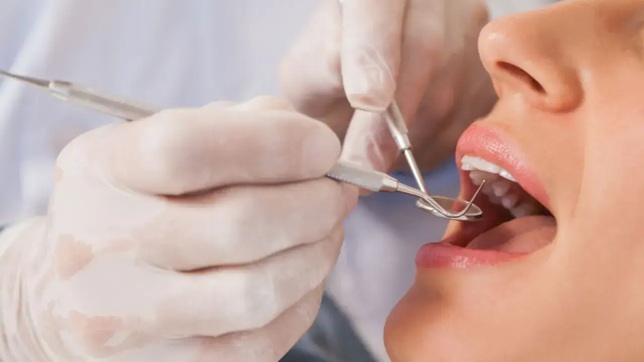 Dentysta wykonuje białe plomby na NFZ. Pacjentka ma otwarte usta, a stomatolog używa narzędzi.