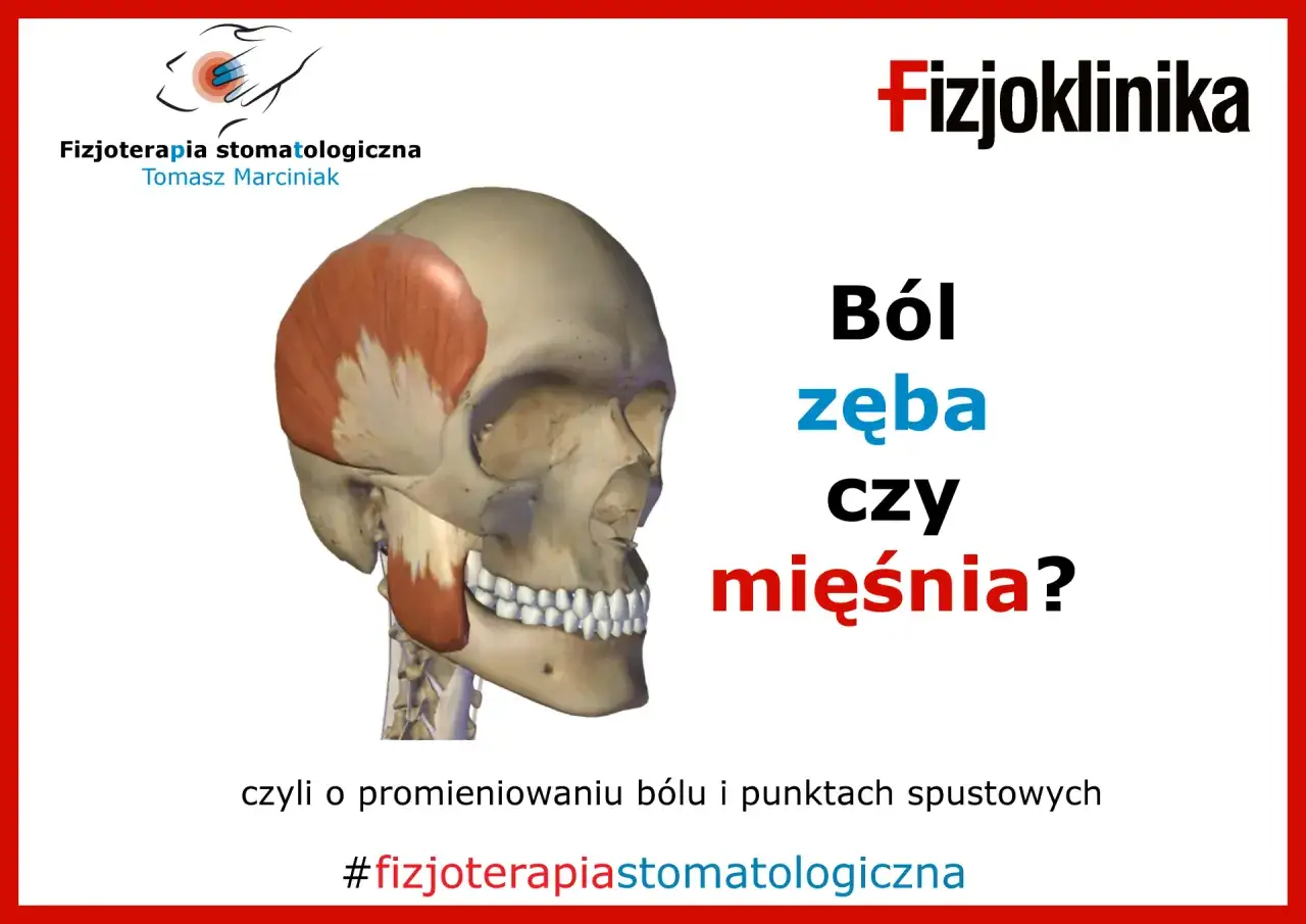 Model czaszki z zaznaczonym mięśniem skroniowym. Jak sprawdzić który ząb boli, czy to ból zęba czy mięśnia? #fizjoterapiastomatologiczna