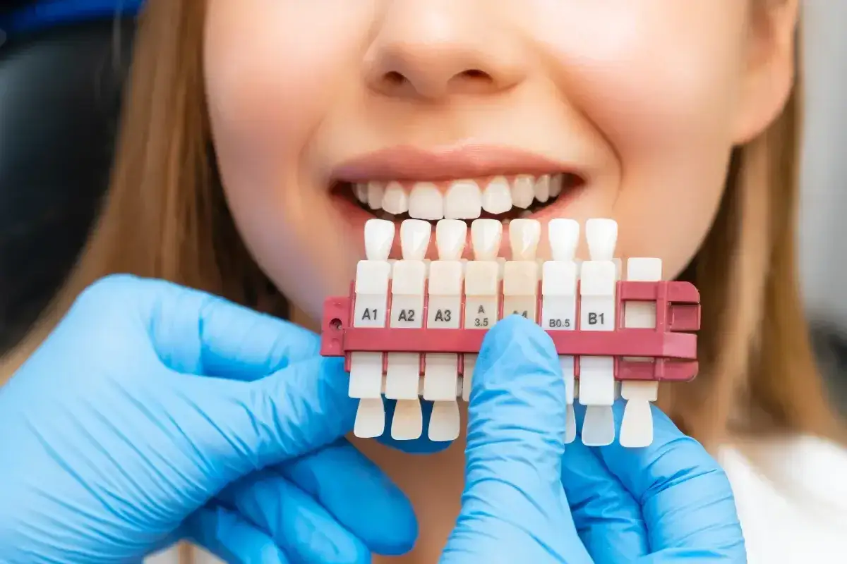 Uśmiechnięta pacjentka z białymi zębami, dentysta w niebieskich rękawiczkach pokazuje wzornik kolorów do wybielania zębów w gabinecie.